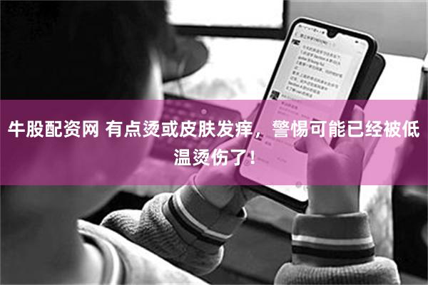 牛股配资网 有点烫或皮肤发痒，警惕可能已经被低温烫伤了！